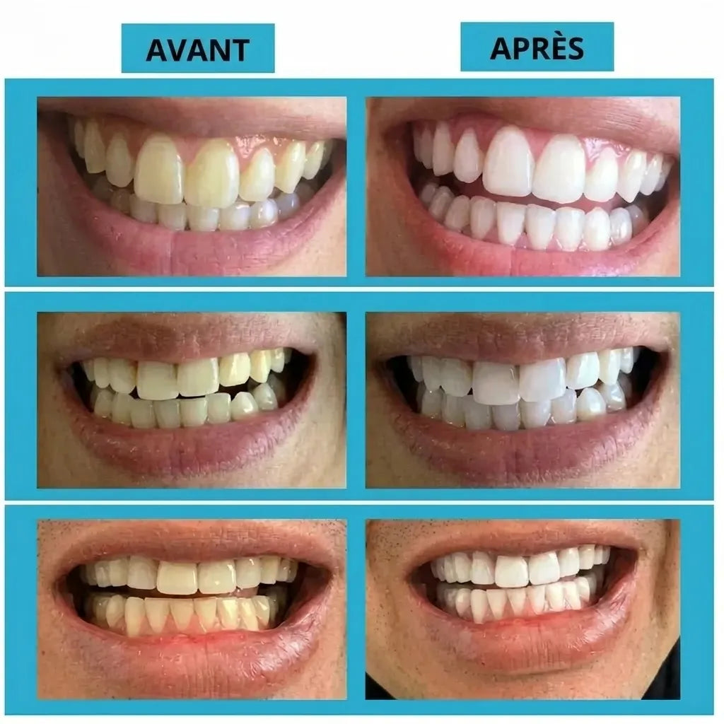 Poudre nettoyante et blanchissante pour les dents | Veiggara