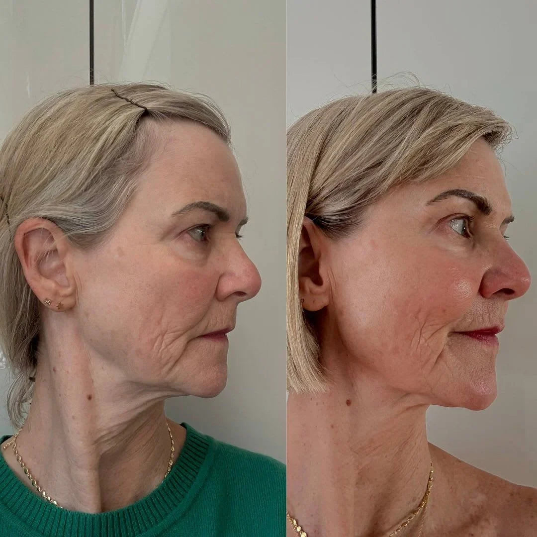 Crème liftante anti-âge Gua Sha | Veiggara